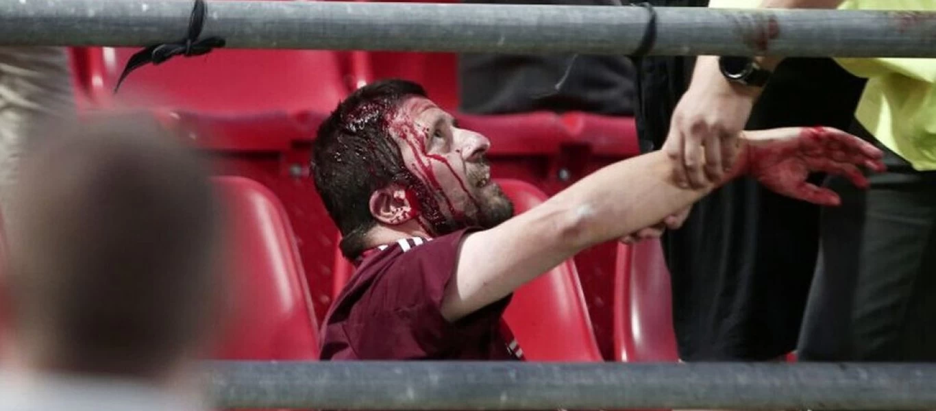 Καταγγελία της Μπάγερν για τον αγώνα του Ρέντη - Τι απαντά η UEFA